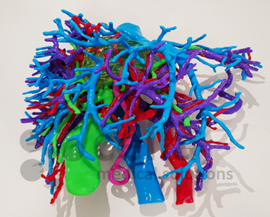 La murciana Cella Medical Solutions imprime órganos en 3D para combatir el cáncer